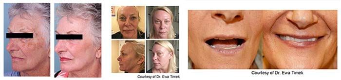 Before and after cosmetic procedure images.