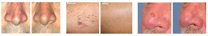 Before and after skin treatment comparisons.