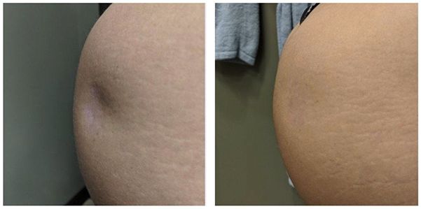 Comparison of skin texture and appearance.