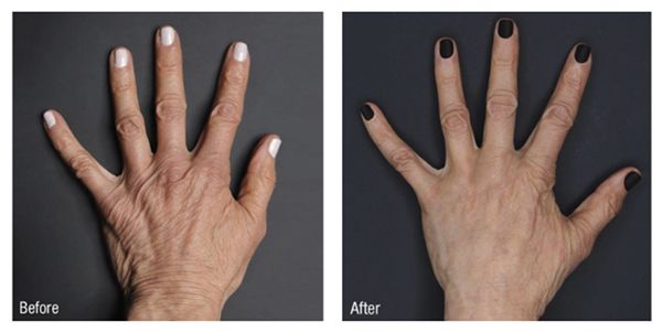 Before and after hand manicure comparison.
