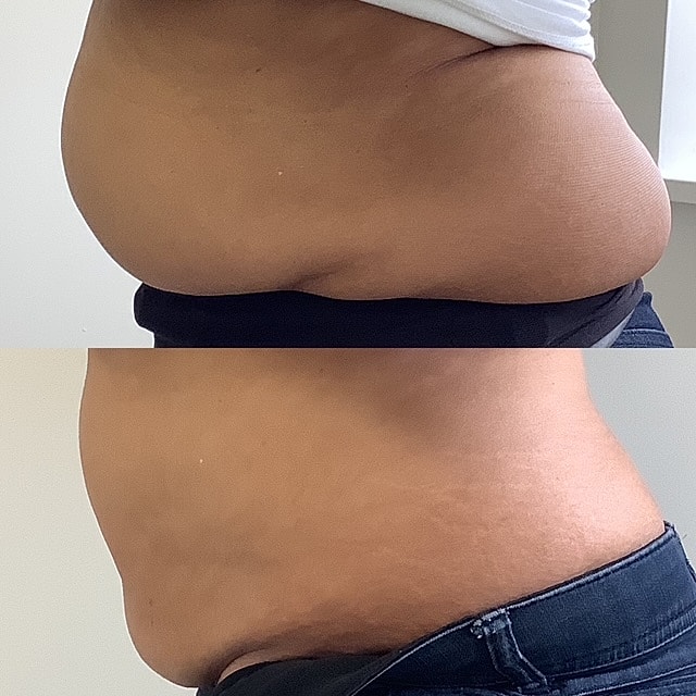 Vanquish ME Before & After