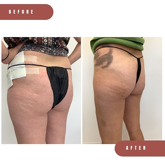 Aveli Before & After