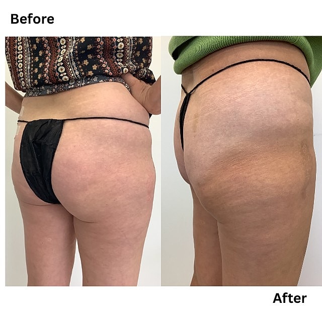 Aveli Before & After