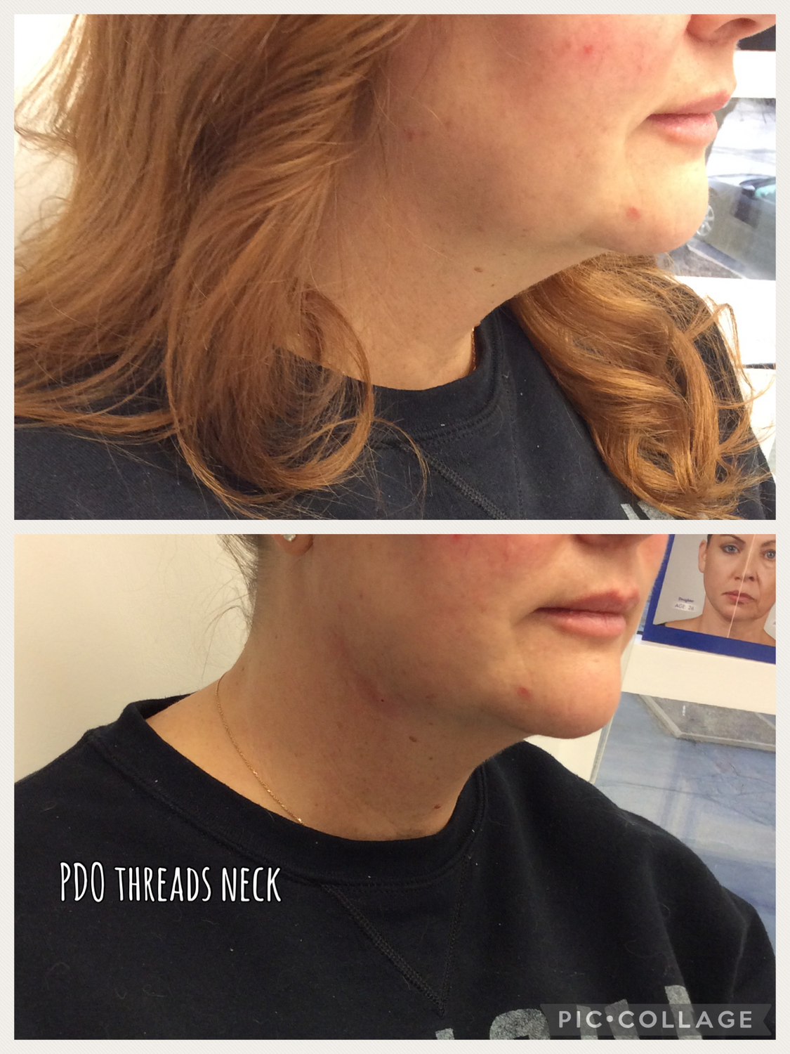 PDO Threads Before & After