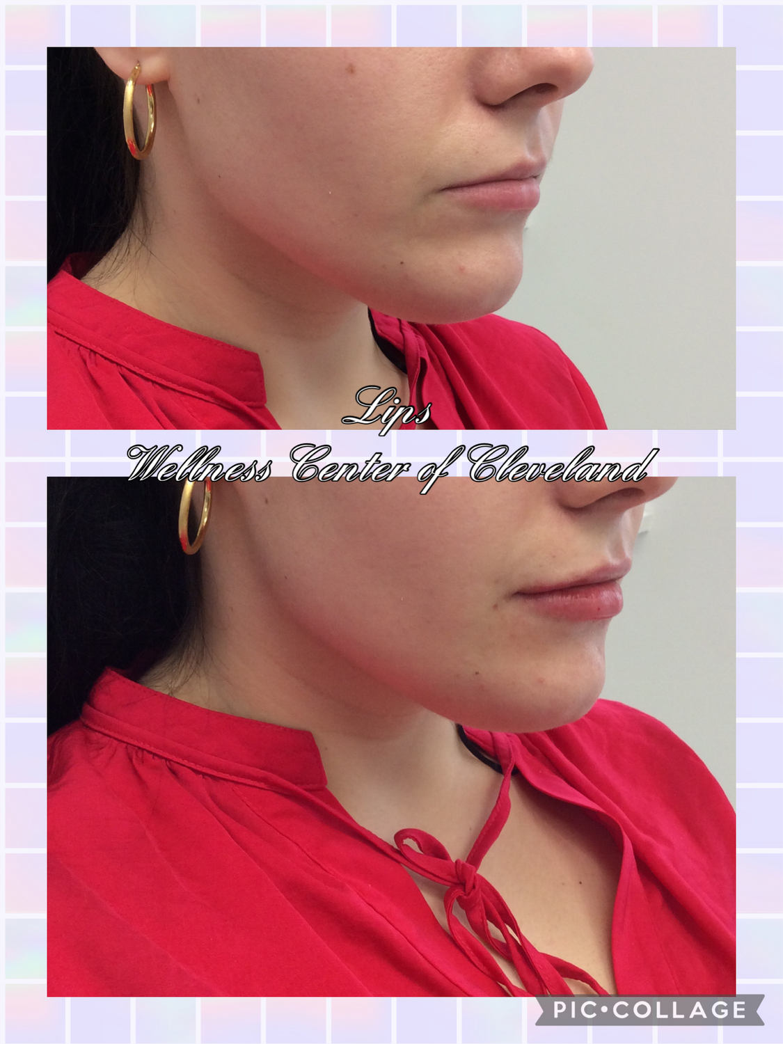 Before and After Photos Before & After