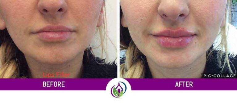 Gallery Images Before & After