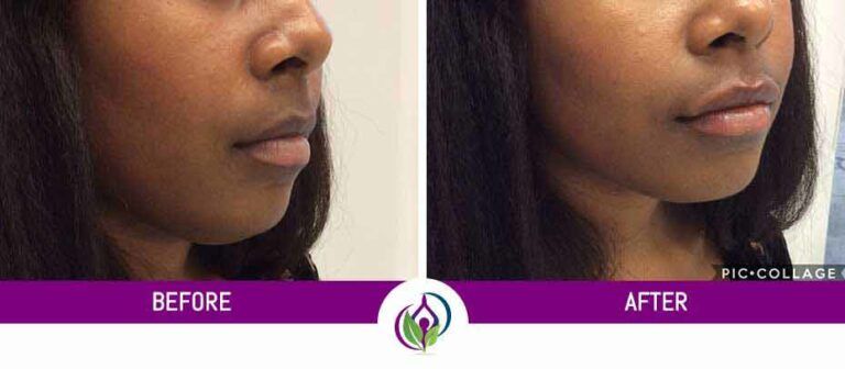 Gallery Images Before & After