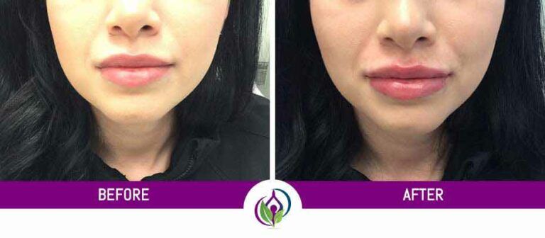 Gallery Images Before & After